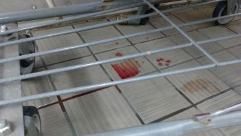 Informe de seguridad alimentaria del consumidor Walmart Supercenter, Lapalco Boulevard, Marrero, LA, USA The meat department is completely hazardous... foto #83