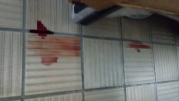 Informe de seguridad alimentaria del consumidor Walmart Supercenter, Lapalco Boulevard, Marrero, LA, USA The meat department is completely hazardous... foto #174