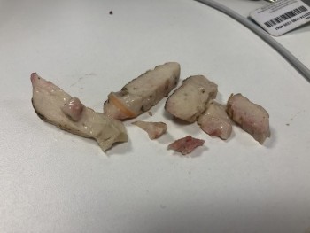 Consumer Food Safety Report Wm Morrison Supermarkets Plc, Gain Lane, Bradford, UK a gross amount of raw chicken in your CC Chick... photo #1
