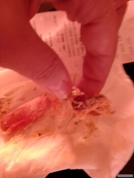 مراجعة المستهلك - سلامة الغذاء Nguni Grill, Morris Street, Bendor, Polokwane, South Africa Toxin build up in my Lymph Glands. High... صورة فوتوغرافية #6