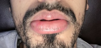 مراجعة المستهلك - سلامة الغذاء Sam's Club, Lycoming Mall Circle, Muncy, PA, USA I ate a banana and my lips swole, mouth was itching... صورة فوتوغرافية #2