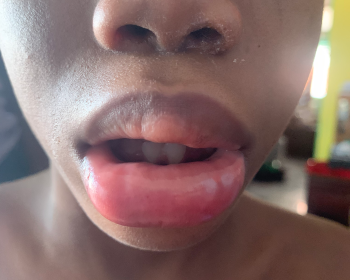 Avis du consommateur - Sécurité alimentaire Noodles, Kingston, Jamaica He ate the noodles and got sick 3/8/2021. My child is in the hospital sin... photo #3
