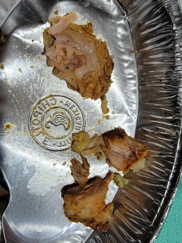 Consumer Food Safety Report Chipotle Mexican Grill, Meridian East, Puyallup, Washington, USA If anyone ate at there around 7:45p... photo #1