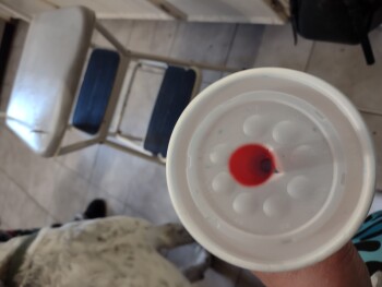 مراجعة المستهلك - سلامة الغذاء Sonic Drive-In, Texas 274, Kemp, TX, USA Food I believe 2
This morning
The bag didn't look like th... صورة فوتوغرافية #3