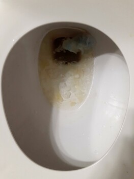 Consumer Review - Food Safety Wendy's, East Hampton Avenue, Mesa, AZ, USA On Tuesday night 04/19/22,I purchased and ate a 4 for 4(... photo #2