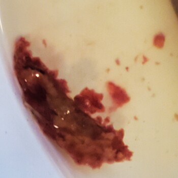Consumer Review - Food Safety Food Pantry, Morris Park Avenue, The Bronx, Bronx, NY, USA Severe stomach pains, diarrhea and blood... photo #2