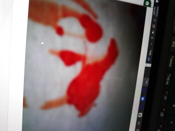 Bericht über die Lebensmittelsicherheit der Verbraucher Taco Bell, Tacoma, WA 98445, USA Blood on my wrapper Foto #3