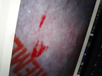 Bericht über die Lebensmittelsicherheit der Verbraucher Taco Bell, Tacoma, WA 98445, USA Blood on my wrapper Foto #6
