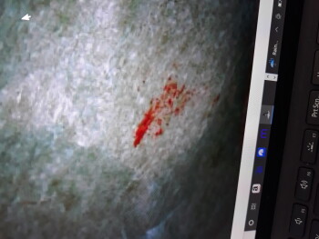 Bericht über die Lebensmittelsicherheit der Verbraucher Taco Bell, Tacoma, WA 98445, USA Blood on my wrapper Foto #4