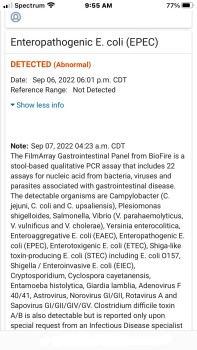 Consumer Review - Food Safety Occidental Cozumel, San Miguel de Cozumel, Quintana Roo, Mexico August 28, 2022,  Lack of food prepa... photo #4