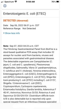 Consumer Review - Food Safety Occidental Cozumel, San Miguel de Cozumel, Quintana Roo, Mexico August 28, 2022,  Lack of food prepa... photo #6