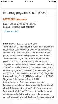 Consumer Review - Food Safety Occidental Cozumel, San Miguel de Cozumel, Quintana Roo, Mexico August 28, 2022,  Lack of food prepa... photo #7