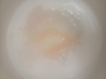 مراجعة المستهلك - سلامة الغذاء Lucky, Arnold Drive, Martinez, CA, USA Suspected food poisoning. Symptoms: other: Tingling sensation... صورة فوتوغرافية #2
