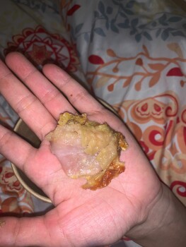 Consumer Review - Food Safety Air Buns Berlin, Silbersteinstraße, Berlin, Germany Suspected food poisoning. Symptoms: Diarrhea, Na... photo #1