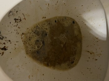 Consumer Review - Food Safety Baskin-Robbins, 15th Avenue, Longview, Washington, USA within a few minutes of drinking on the milks... photo #2