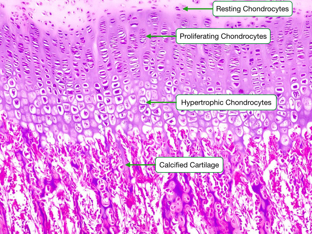 Histological image showing chondrocytes proliferating and growing during endochondrial ossification.