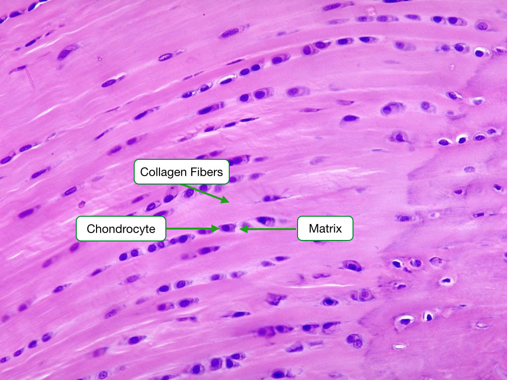 H and E stained sample showing fibrocartilage.