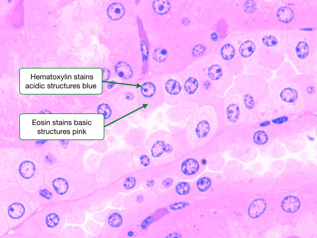 Hematoxylin and eosin are the dyes most commonly used in histology.