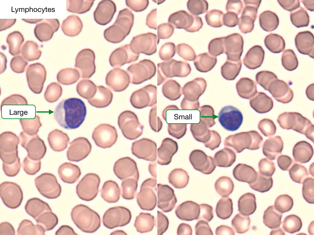 Lymphocytes